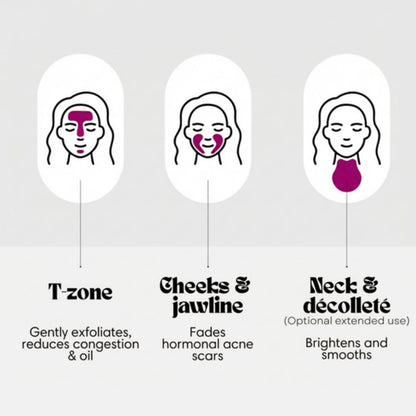 Névara Alpha Arbutin + TXA Cream