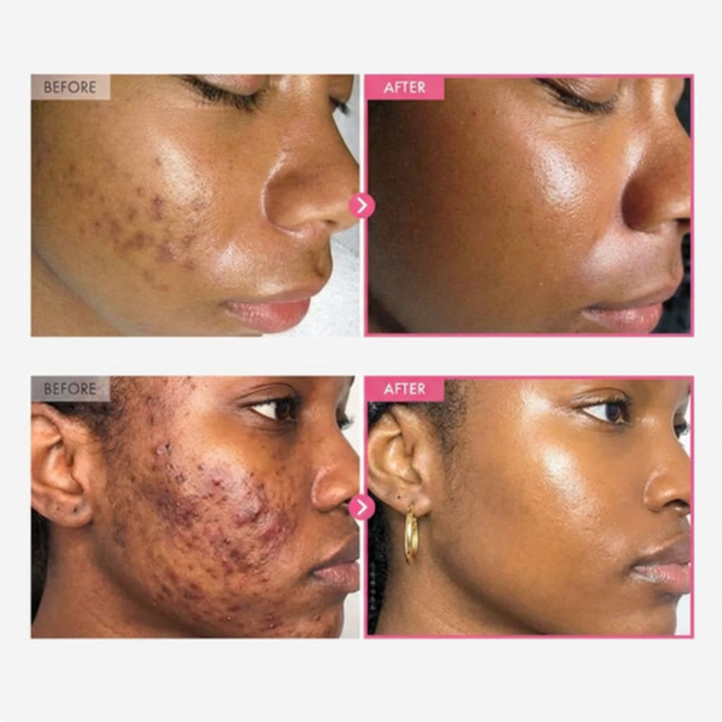 Névara Alpha Arbutin + TXA Cream